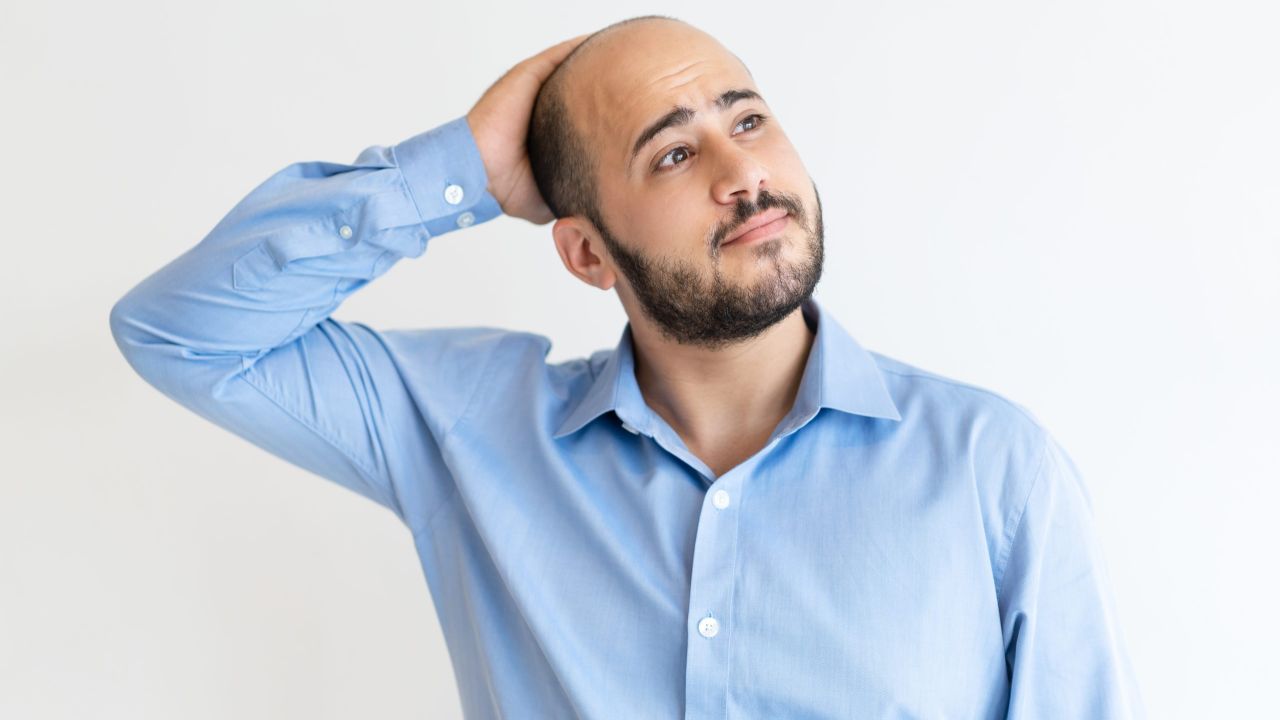 Queda de cabelo em homens